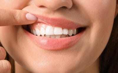 6 Ways to Keep Your Gums Healthy