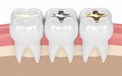 Understanding Dental Fillings: Types and Materials