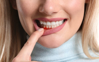 Preventing and Treating Periodontal Disease: Tips for Healthy Gums