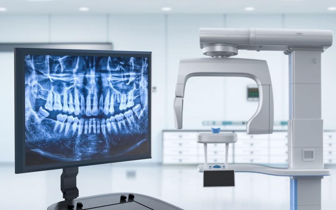 Top Benefits of Digital X-Rays Over Traditional Imaging