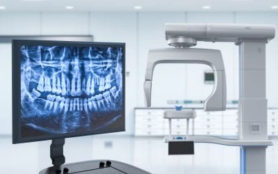 Top Benefits of Digital X-Rays Over Traditional Imaging