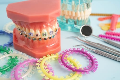 The Different Types of Orthodontic Treatments