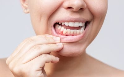 Early Signs of Gum Disease: Prevention Tips for Healthy Gums