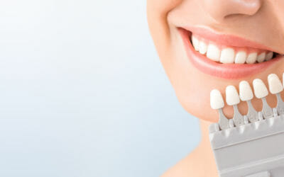 Teeth Whitening 101: Everything You Need to Know